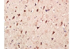 Immunohistochemistry (Paraffin-embedded Sections) (IHC (p)) image for anti-Matrix Metalloproteinase 2 (MMP2) (AA 31-109) antibody (ABIN668286)