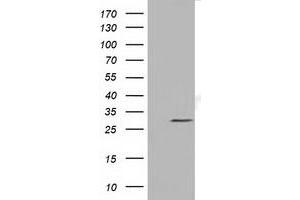 HEK293T cells were transfected with the pCMV6-ENTRY control (Left lane) or pCMV6-ENTRY NSMCE2 (Right lane) cDNA for 48 hrs and lysed. (NSMCE2 anticorps)