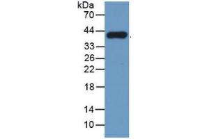 Western Blotting (WB) image for Tryptase alpha/beta 1 (TPSAB1) ELISA Kit (ABIN6574250)