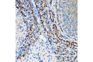 Immunohistochemistry of paraffin-embedded rat ovary using SRP19 antibody (ABIN5974084) at dilution of 1/100 (40x lens). (SRP19 anticorps)