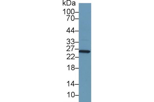 GSTA1 anticorps  (AA 2-222)