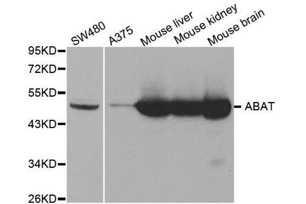 ABAT anticorps  (AA 29-300)