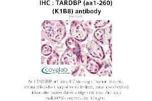 Image no. 1 for anti-TAR DNA Binding Protein (TARDBP) (AA 1-260) antibody (ABIN1723216) (TARDBP anticorps  (AA 1-260))