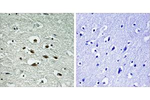 Immunohistochemistry analysis of paraffin-embedded human brain tissue using Chk1 (Phospho-Ser296) antibody. (CHEK1 anticorps  (pSer296))