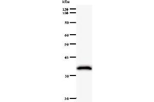 Western Blotting (WB) image for anti-ATP-Dependent RNA Helicase A (DHX9) antibody (ABIN932191) (DHX9 anticorps)