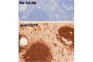 Immunohistochemistry (IHC) image for anti-CD19 Molecule (CD19) (C-Term) antibody (ABIN6254219) (CD19 anticorps  (C-Term))