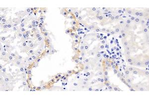 Detection of MMP3 in Human Kidney Tissue using Polyclonal Antibody to Matrix Metalloproteinase 3 (MMP3) (MMP3 anticorps  (AA 247-370))