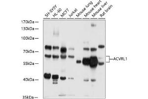 Western blot analysis of extracts of various cell lines, using  antibody (ABIN6129872, ABIN6136507, ABIN6136508 and ABIN6218899) at 1:1000 dilution. (ACVRL1 anticorps)