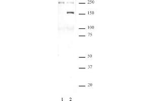SMC1 phospho Ser957 pAb tested by Western blot. (SMC1A anticorps  (pSer957))