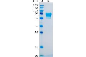 Human CD27 Protein, hFc Tag on SDS-PAGE under reducing condition. (CD27 Protein (AA 20-191) (Fc Tag))