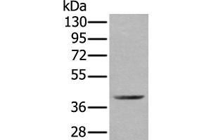 Western blot analysis of Mouse kidney tissue lysate using WDFY2 Polyclonal Antibody at dilution of 1:350 (WDFY2 anticorps)