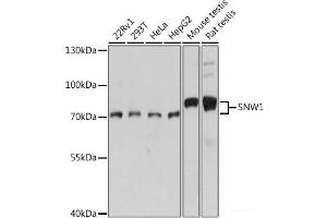 Western blot analysis of extracts of various cell lines using SNW1 Polyclonal Antibody at dilution of 1:1000. (SNW1 anticorps)