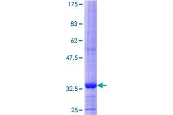 HGD Protein (AA 377-445) (GST tag)