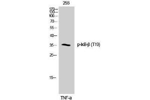 Western Blotting (WB) image for anti-NF-kappa-B inhibitor beta (NFKBIB) (pThr19) antibody (ABIN3173002) (NFKBIB anticorps  (pThr19))