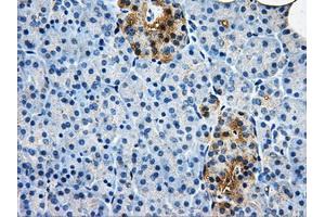 Immunohistochemistry (IHC) image for anti-Aldo-Keto Reductase Family 1, Member A1 (Aldehyde Reductase) (AKR1A1) antibody (ABIN1496544) (AKR1A1 anticorps)