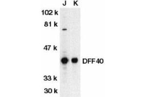 Western blot analysis of DFF40 in Jurkat (J) and K562 (K) whole cell lysate with DFF40 antibody at 2ug/ml. (DFFB anticorps  (AA 3-18))