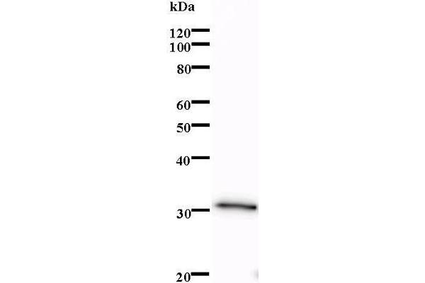 LMO1 anticorps