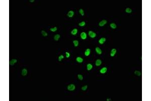 Immunofluorescence staining of Hela cells with ABIN7127720 at 1:100,counter-stained with DAPI. (Recombinant NRF2 anticorps  (pSer40))