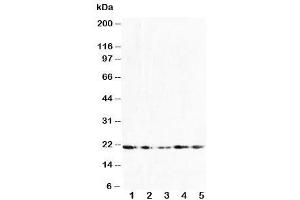 Western blot testing of FGF10 antibody and Lane 1:  U87 (FGF10 anticorps  (N-Term))