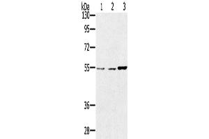Western Blotting (WB) image for anti-Sestrin 2 (SESN2) antibody (ABIN2433786) (Sestrin 2 anticorps)