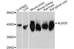 Western blot analysis of extracts of various cell lines, using ALDOC Antibody. (ALDOC anticorps)