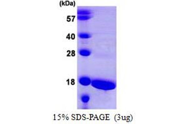 ATP5F1D Protein (AA 23-168) (His tag)