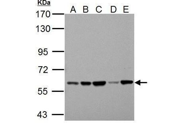 Pyruvate Kinase anticorps  (Center)