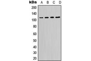 Western blot analysis of PI3K p110 delta expression in K562 (A), Raji (B), Raw264. (PIK3CD anticorps  (C-Term))