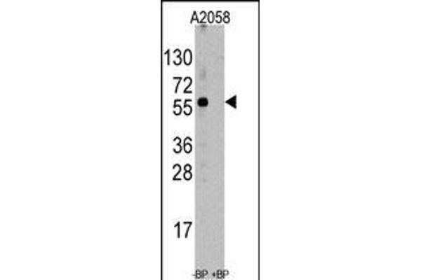 HSC70 Interacting Protein HIP anticorps  (AA 50-80)
