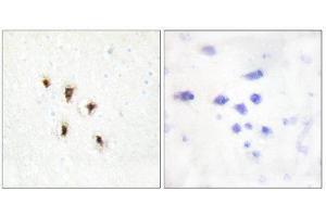 Immunohistochemistry (IHC) image for anti-Mevalonate Kinase (MVK) (Internal Region) antibody (ABIN1849535) (MVK anticorps  (Internal Region))