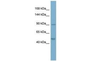 Image no. 1 for anti-Plakophilin 2 (PKP2) (AA 143-192) antibody (ABIN6741984) (Plakophilin 2 anticorps  (AA 143-192))