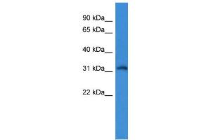 WB Suggested Anti-KCNIP4 Antibody Titration: 0. (KCNIP4 anticorps  (N-Term))