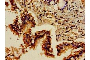 Immunohistochemistry of paraffin-embedded human lung tissue using ABIN7154494 at dilution of 1:100 (PIK3R1 anticorps  (AA 15-180))