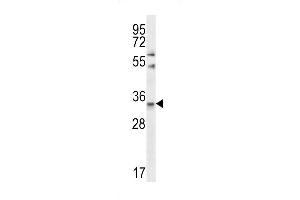Western blot analysis in Jurkat cell line lysates (35ug/lane). (Elastase 3A anticorps  (AA 157-186))
