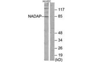 Western blot analysis of extracts from HuvEc cells, using NADAP Antibody. (NADAP anticorps  (AA 421-470))