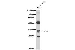 Western blot analysis of extracts of mouse heart, using FGF23 antibody. (FGF23 anticorps)