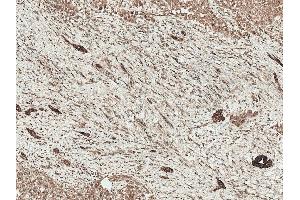 Immunohistochemistry analysis using Rabbit Anti-LRP1 Polyclonal Antibody (ABIN5696062). (LRP1 anticorps  (AA 160-260) (PE))