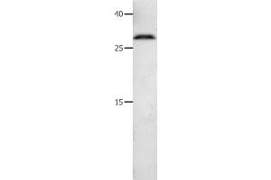 Western Blot analysis of 231 cell using MMP7 Polyclonal Antibody at dilution of 1:600 (MMP7 anticorps)