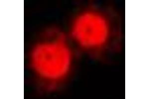 Immunofluorescent analysis of Annexin A1 staining in NIH3T3 cells. (Annexin a1 anticorps  (Center))