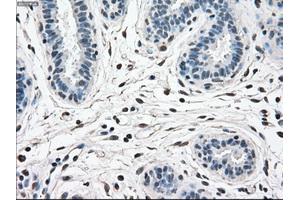 Immunohistochemical staining of paraffin-embedded breast tissue using anti-MAPK1 mouse monoclonal antibody. (ERK2 anticorps)