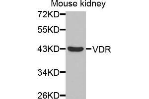Western blot analysis of extracts of mouse kidney, using VDR antibody. (Vitamin D Receptor anticorps)