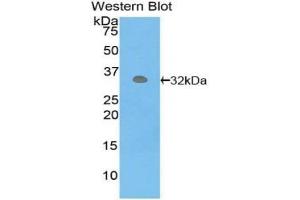 Western blot analysis of the recombinant protein. (PCK1 anticorps  (AA 311-558))