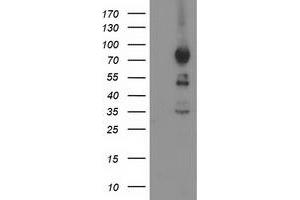 HEK293T cells were transfected with the pCMV6-ENTRY control (Left lane) or pCMV6-ENTRY ASCC2 (Right lane) cDNA for 48 hrs and lysed. (ASCC2 anticorps)