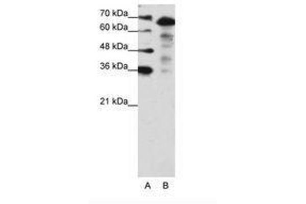 MLXIPL anticorps  (N-Term)