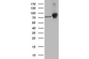 HEK293T cells were transfected with the pCMV6-ENTRY control (Left lane) or pCMV6-ENTRY CTNNB1 (Right lane) cDNA for 48 hrs and lysed. (CTNNB1 anticorps)