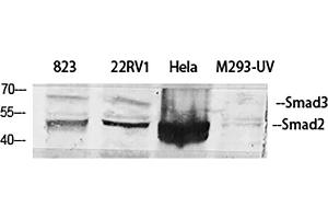 Western Blot analysis of 823 (1), 22RV1 (2), Hela (3), M293-UV (4), diluted at 1:500. (Smad2/3 anticorps)