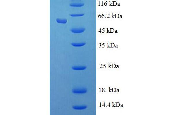 RBBP7 Protein (AA 1-425, full length) (His-SUMO Tag)