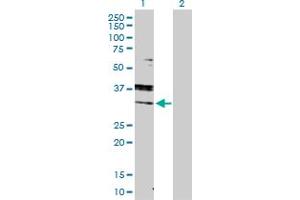 Western Blot analysis of RAB7A expression in transfected 293T cell line by RAB7A MaxPab polyclonal antibody. (RAB7A anticorps  (AA 1-207))