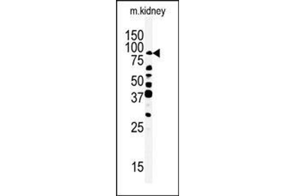 RIPK4 anticorps  (C-Term)