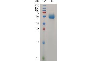 Human  IL31 Protein, hFc Tag on SDS-PAGE under reducing condition. (IL-31 Protein (AA 24-164) (Fc Tag))
